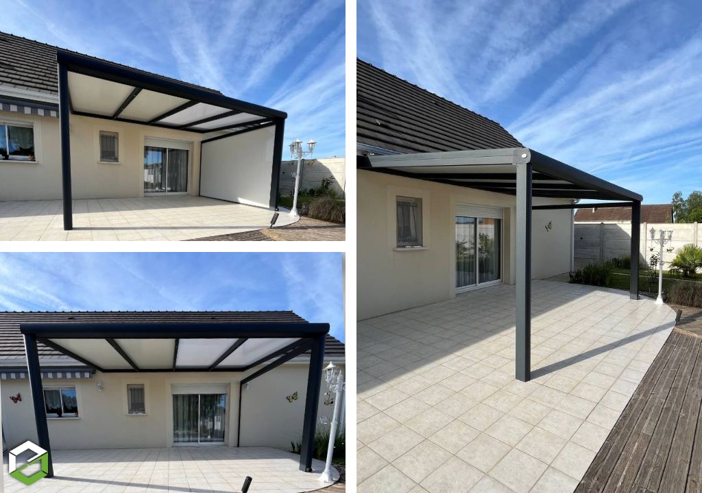 Installation d’une pergola aluminium sur mesure -Loir et Cher (41)